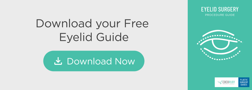 Blepharoplasty Guide Download